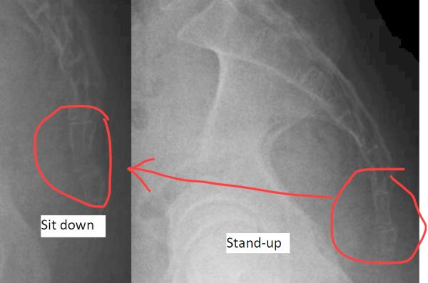 sit/stand x-ray